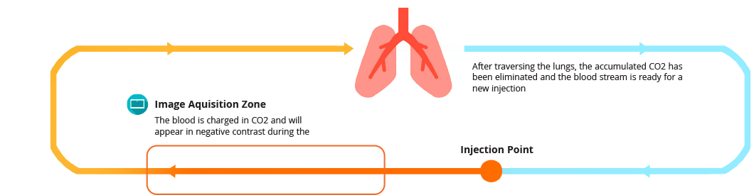 Injecteur CO2,Injecteur angiographique,Angiographie CO2,injecteur vimap technologies,agent de contraste